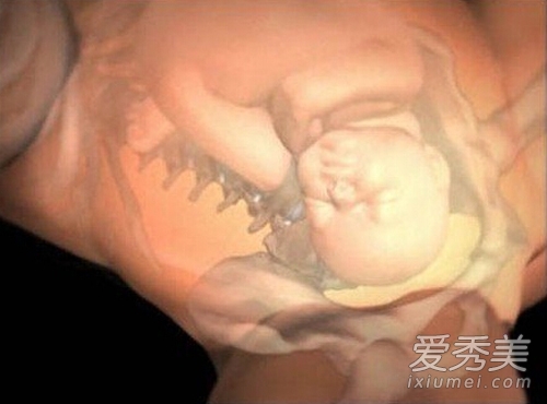 图揭:孕妇生孩子全过程