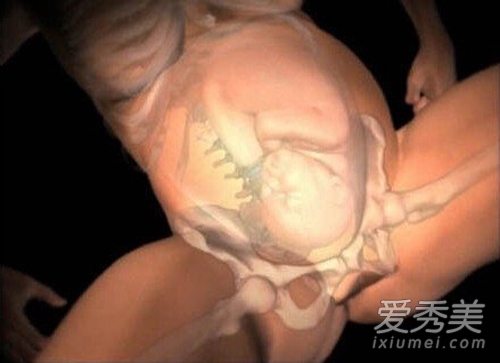 图揭:孕妇生孩子全过程