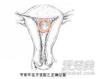 ���д���ս��������Ů�˸��������ֱ��з�ʽ