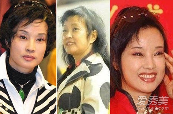 刘晓庆承认整容 40年容貌变化只是小调整?