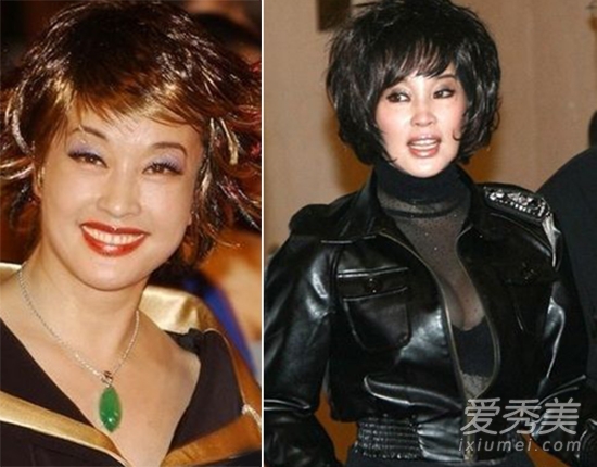 刘晓庆承认整容 40年容貌变化只是小调整?