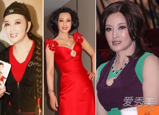 刘晓庆承认整容 40年容貌变化只是小调整?
