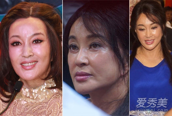 刘晓庆承认整容 40年容貌变化只是小调整?
