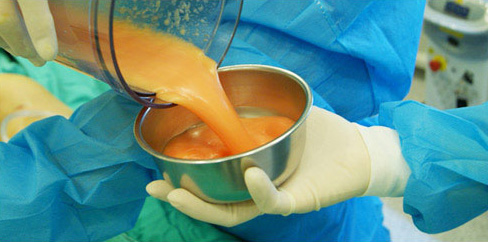 ���룡ʵ������֬����������ȫ��_����֬������