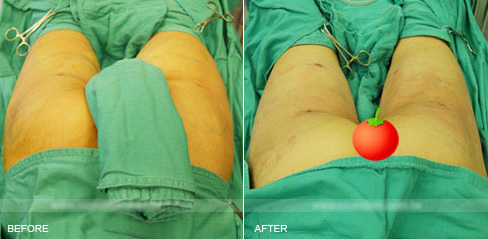 ���룡ʵ������֬����������ȫ��_����֬������