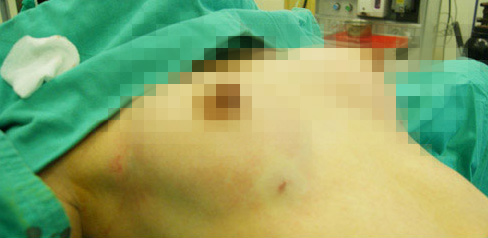 ���룡ʵ������֬����������ȫ��_����֬������