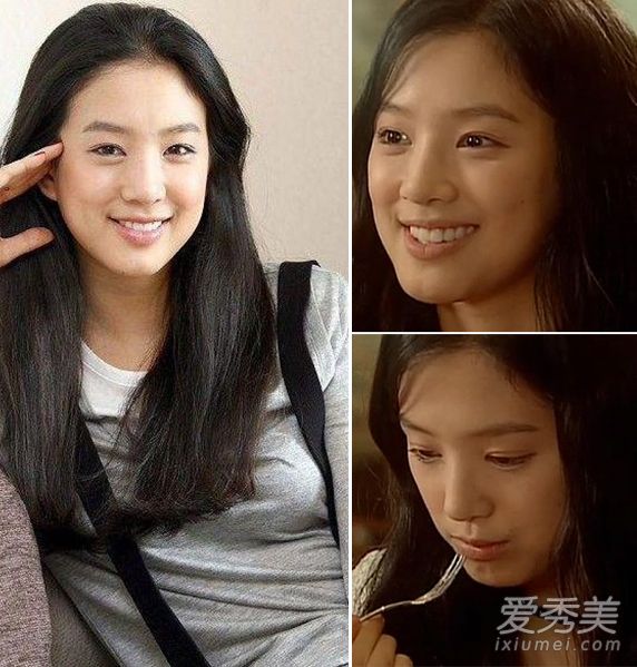 郑丽媛整容失败变残 《金三顺》10年后颜值恢复_郑丽媛整容前后照片