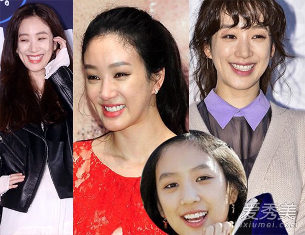 郑丽媛整容失败变残 《金三顺》10年后颜值恢复_郑丽媛整容前后照片