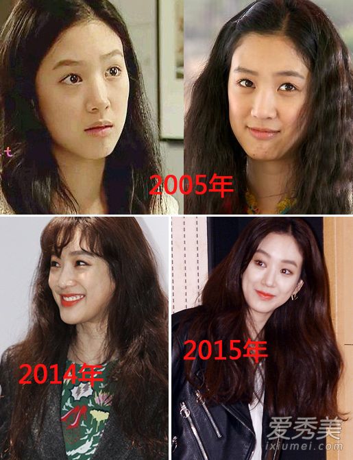 郑丽媛整容失败变残 《金三顺》10年后颜值恢复_郑丽媛整容前后照片