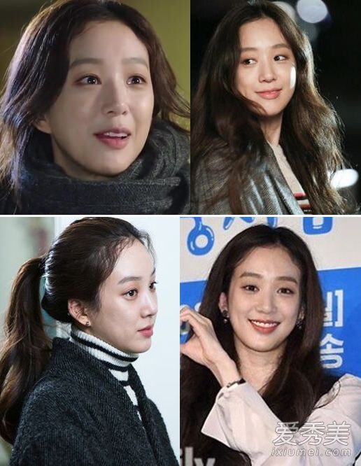 郑丽媛整容失败变残 《金三顺》10年后颜值恢复_郑丽媛整容前后照片