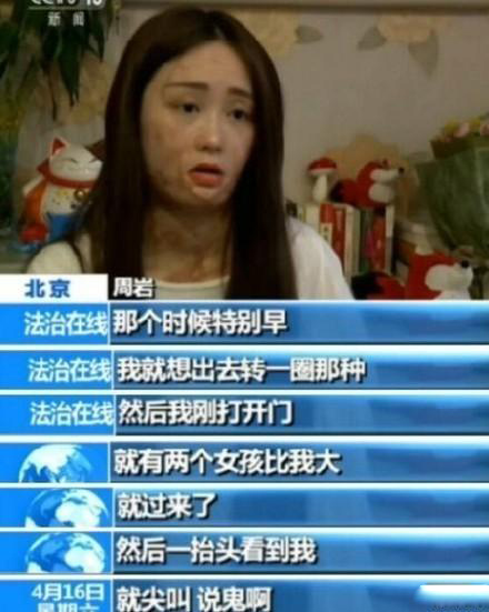 毁容少女晒写真 周岩毁容前照片个人资料微博_周岩事件真相