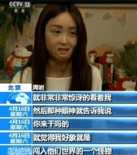 毁容少女晒写真 周岩毁容前照片个人资料微博_周岩事件真相
