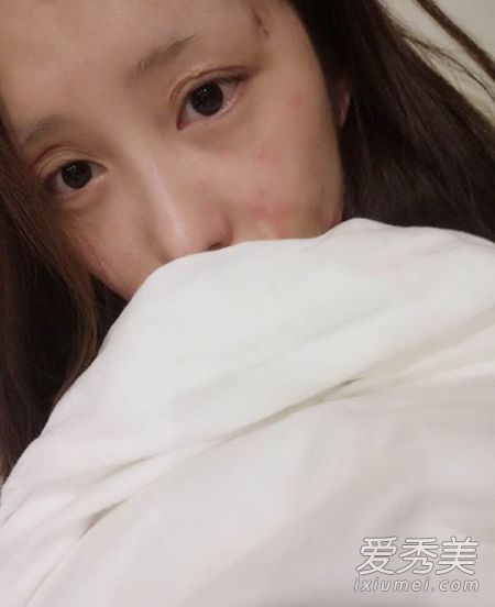 毁容少女晒写真 周岩毁容前照片个人资料微博_周岩事件真相