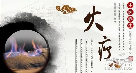 ���ƿ����������� ��������ʲô����