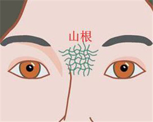 克夫相女人标准图片 克夫相女人怎么破解