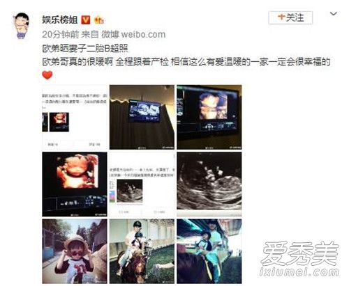 ŷ��ɹ���Ӷ�̥B��������ô���� ŷ�����Ӷ�̥Ԥ������ʲôʱ��