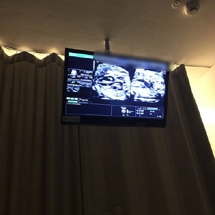 ŷ��ɹ���Ӷ�̥B��������ô���� ŷ�����Ӷ�̥Ԥ������ʲôʱ��