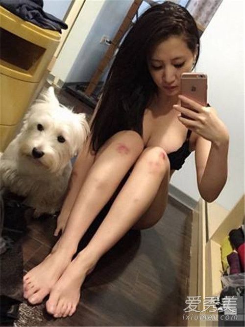 女生膝盖淤青是什么梗 女生膝盖淤青是什么意思