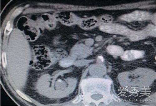 ����2980�Ž�ʯ����ô���� ���Ԥ����ʯ