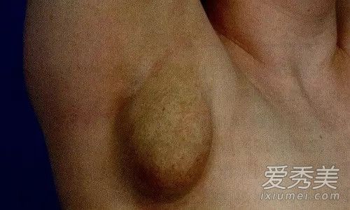 �ٸ�����ô���� �ٸ�����渱���������ʲô