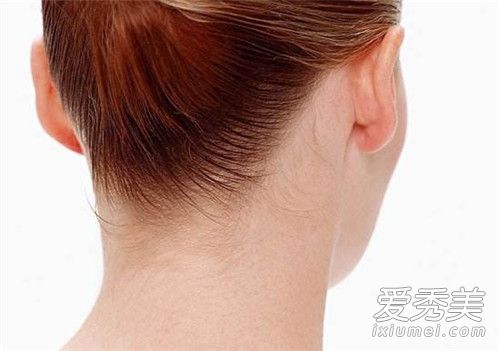 富贵包怎么形成的 富贵包怎样彻底消除