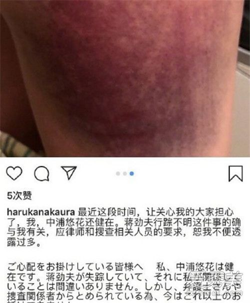 ���������ٲ�����ʲô��� ���������ٲ���ԭ��