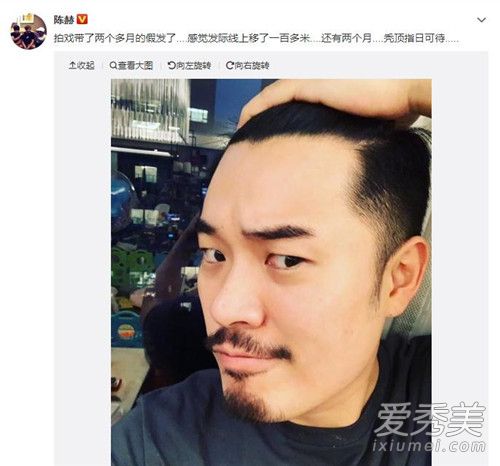 陈赫秃顶指日可待 拍戏带假发导致发际线上移
