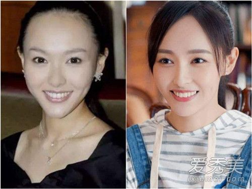 陈赫秃顶指日可待 拍戏带假发导致发际线上移