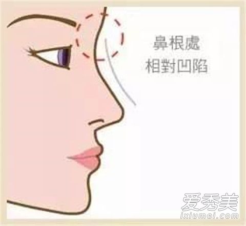 ɽ������ô���� ɽ������ô���