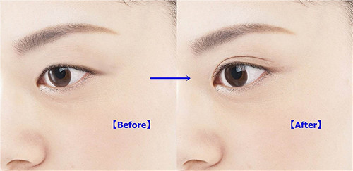 �����ݼ������������� ��������������