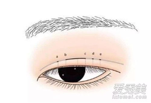 肿眼泡减肥能瘦下来吗 肿眼泡能消除吗