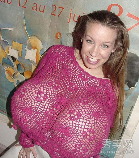 世界最大胸部每只乳重达18斤超惊悚