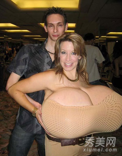 世界最大胸部每只乳重达18斤超惊悚