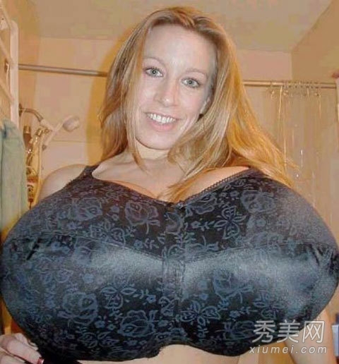 世界最大胸部每只乳重达18斤超惊悚