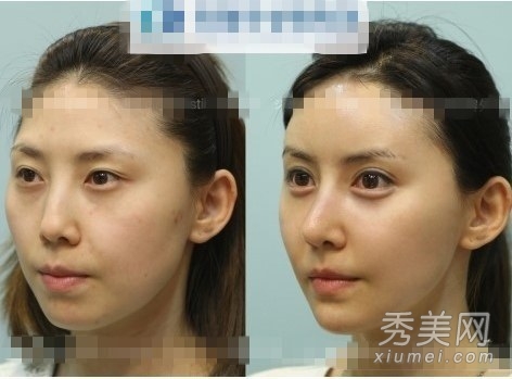 ̫���棡������Ů����ǰ���˶Ա�