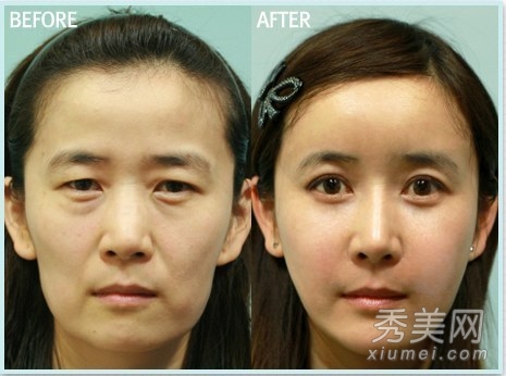 ̫���棡������Ů����ǰ���˶Ա�