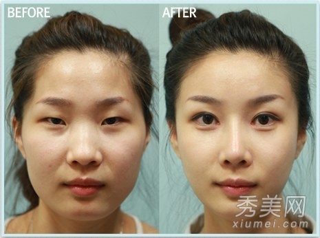 ̫���棡������Ů����ǰ���˶Ա�