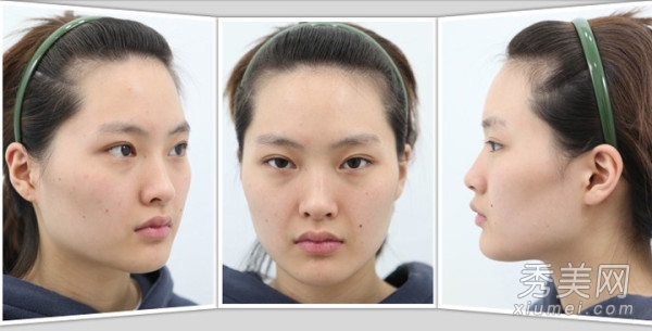 ̫���棡������Ů����ǰ���˶Ա�