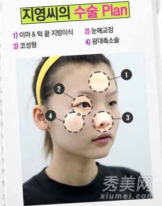 ̫���棡������Ů����ǰ���˶Ա�