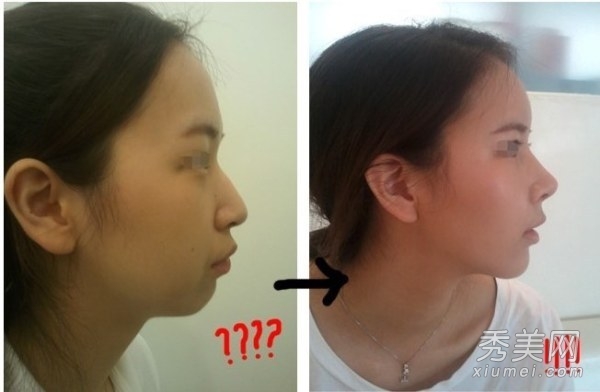 ̫���棡������Ů����ǰ���˶Ա�