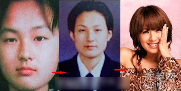 蔡妍尹恩惠 15位韩女星旧照揭秘整容历程