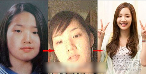 蔡妍尹恩惠 15位韩女星旧照揭秘整容历程
