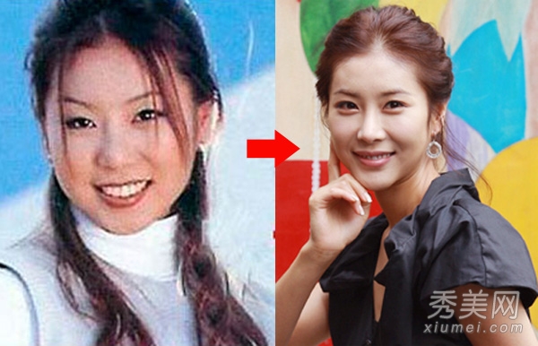 蔡妍尹恩惠 15位韩女星旧照揭秘整容历程