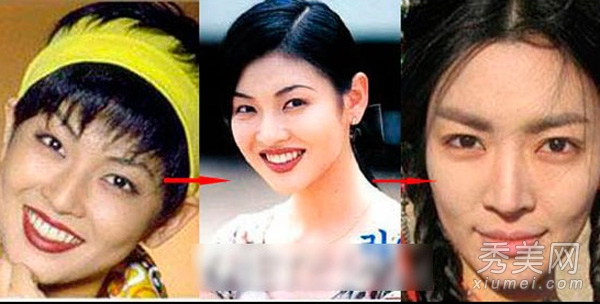 蔡妍尹恩惠 15位韩女星旧照揭秘整容历程