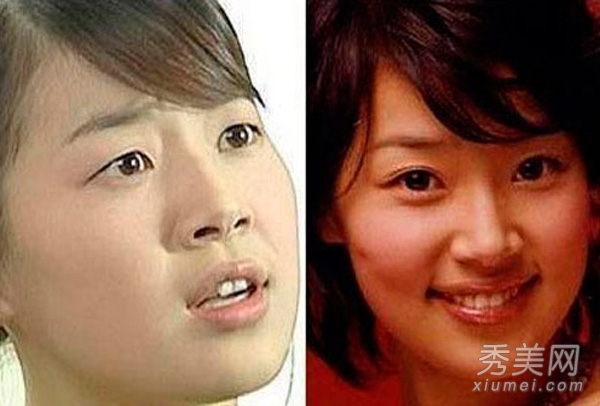 蔡妍尹恩惠 15位韩女星旧照揭秘整容历程