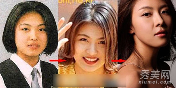 蔡妍尹恩惠 15位韩女星旧照揭秘整容历程