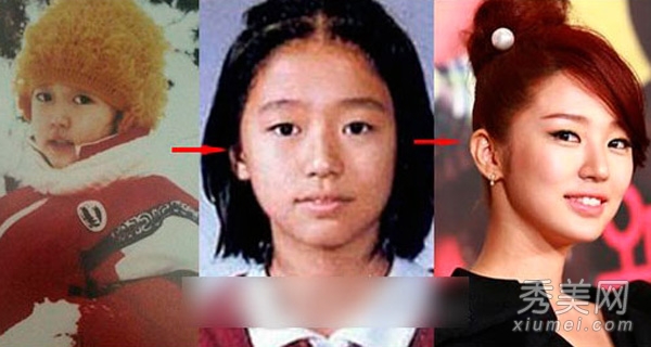 蔡妍尹恩惠 15位韩女星旧照揭秘整容历程