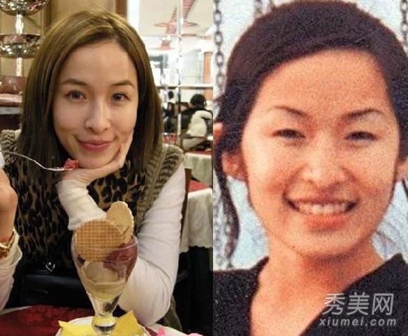 欧弟戴军李玟周迅 盘点割双眼皮的明星