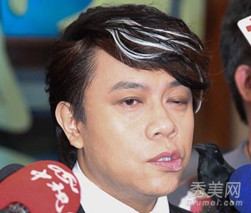 蔡康永“面瘫” 揭开明星整容失败真相