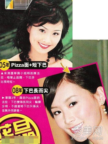 蔡康永“面瘫” 揭开明星整容失败真相